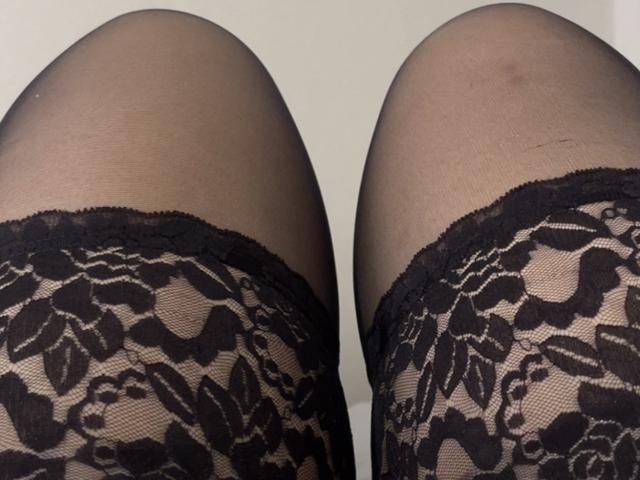 AlinaMilf's legs in black lace-topped sheer stockings, showing her thighs and a small bruise on her right leg. The lace has a floral pattern, and the shot is up-close.